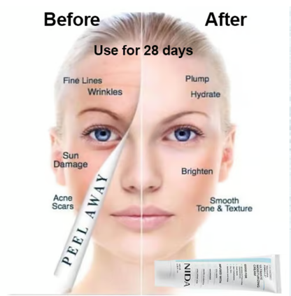 🎉NIDA Youthful Formula Ultimate Moisturizing Cream